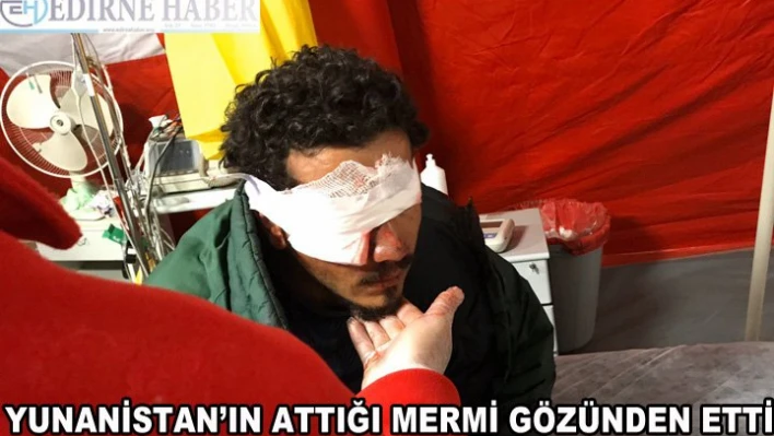 Yunanistan'ın attığı plastik mermi sığınmacıyı gözünden etti