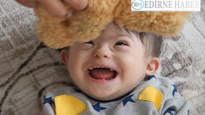 Mert bebek, duymak için ameliyat olacağı günü bekliyor