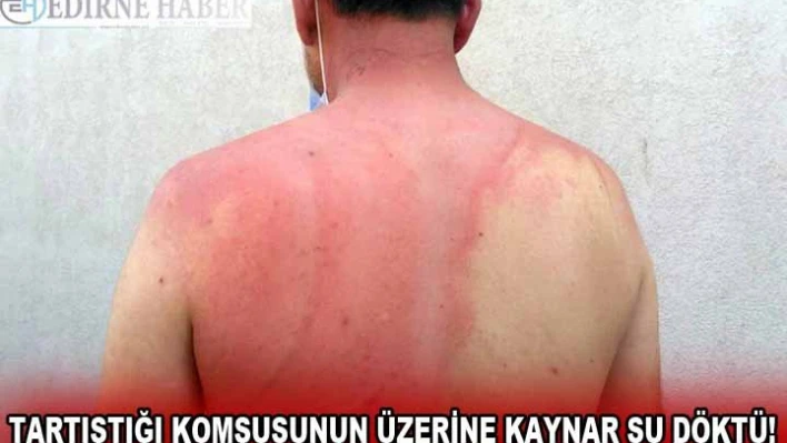 Edirne'de tartıştığı komşusunun üzerine kaynar su döken kişi gözaltına alındı