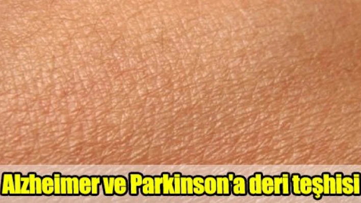 Alzheimer ve Parkinson'a deri teşhisi