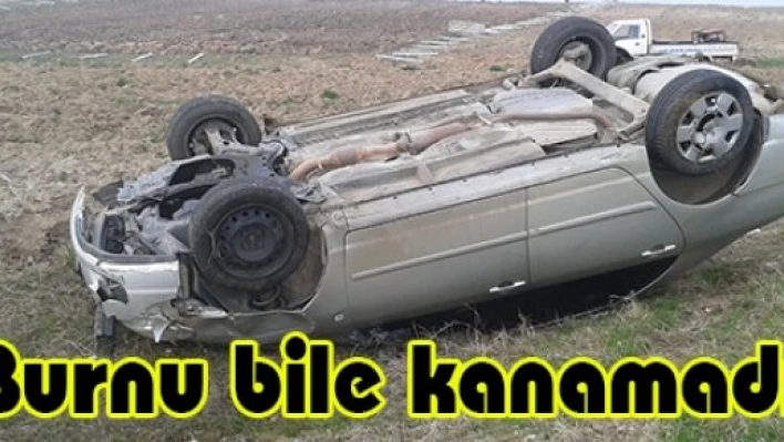 Burnu bile kanamadı