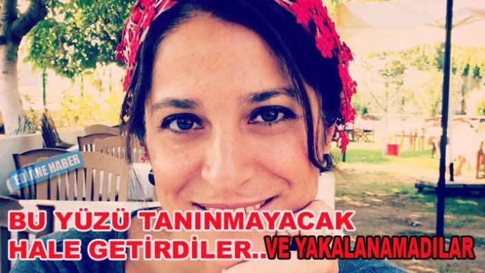 Doktorun yüzünü yoğun bakımda parçaladılar