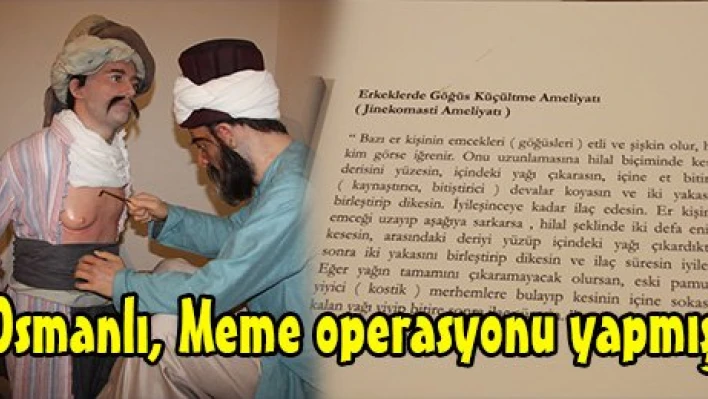 Osmanlı, Meme operasyonu yapmış