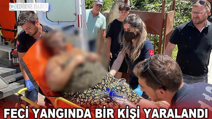 Feci yangında bir kişi yaralandı