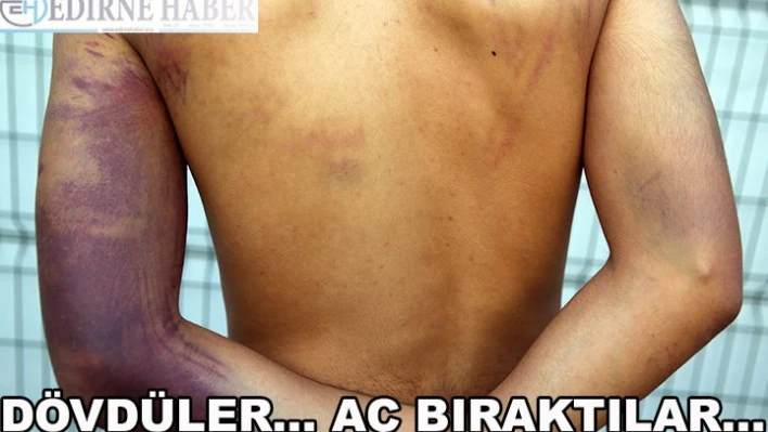 Dövdüler... Aç bıraktılar...