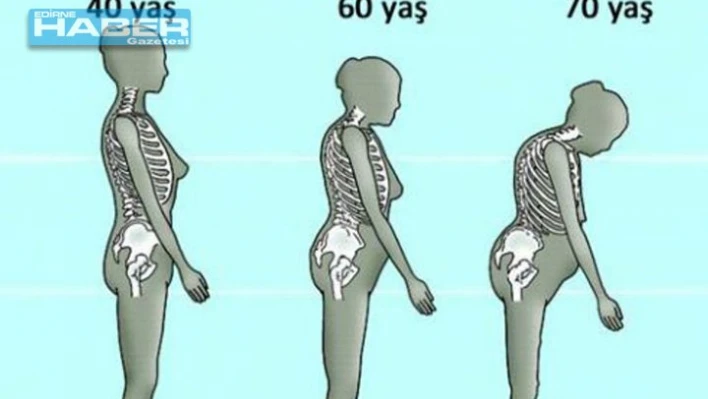 10 adımda kemik erimesini önleyin