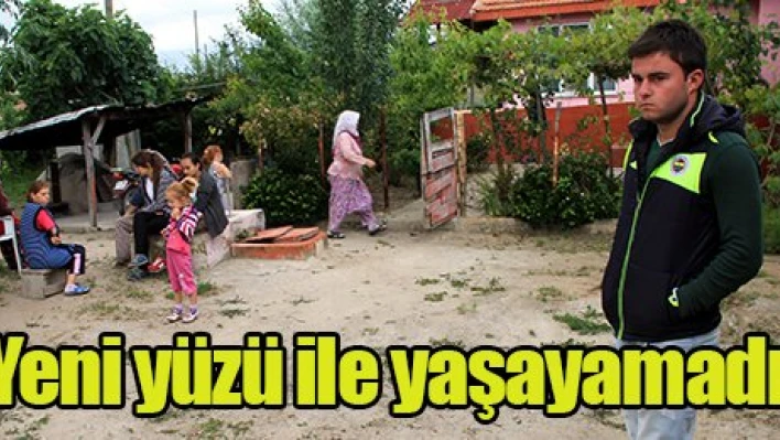 Yeni yüzü ile yaşayamadı