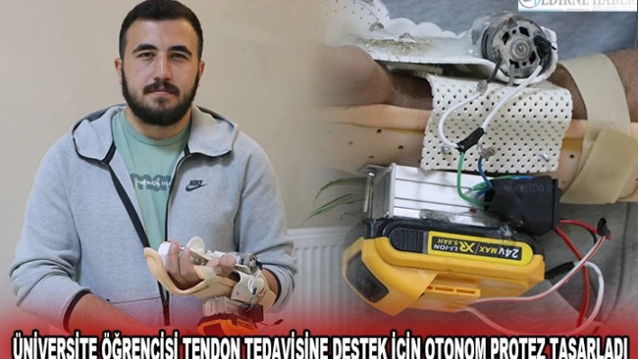 ÜNİVERSİTE ÖĞRENCİSİ TENDON TEDAVİSİNE DESTEK İÇİN OTONOM PROTEZ TASARLADI