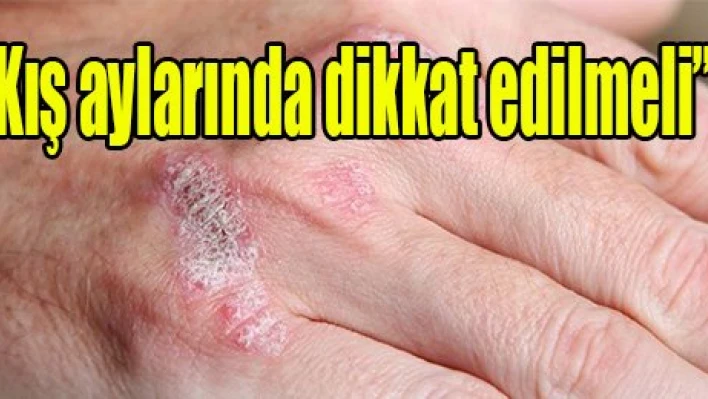 'Kış aylarında dikkat edilmeli'