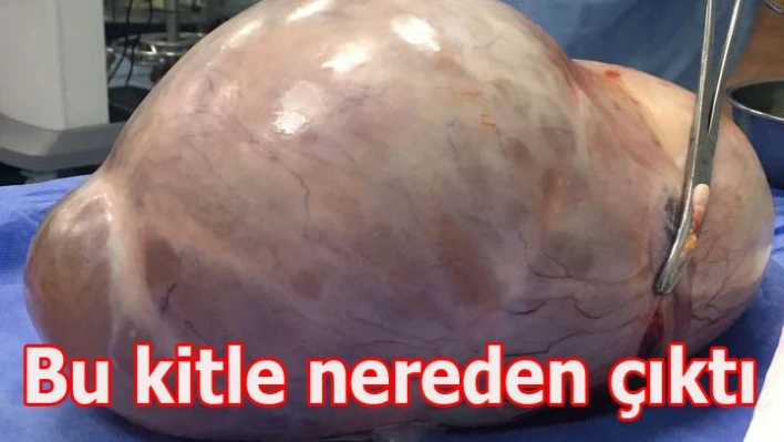 6 Kg. Kist
