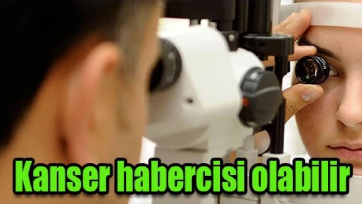 Kanser habercisi olabilir