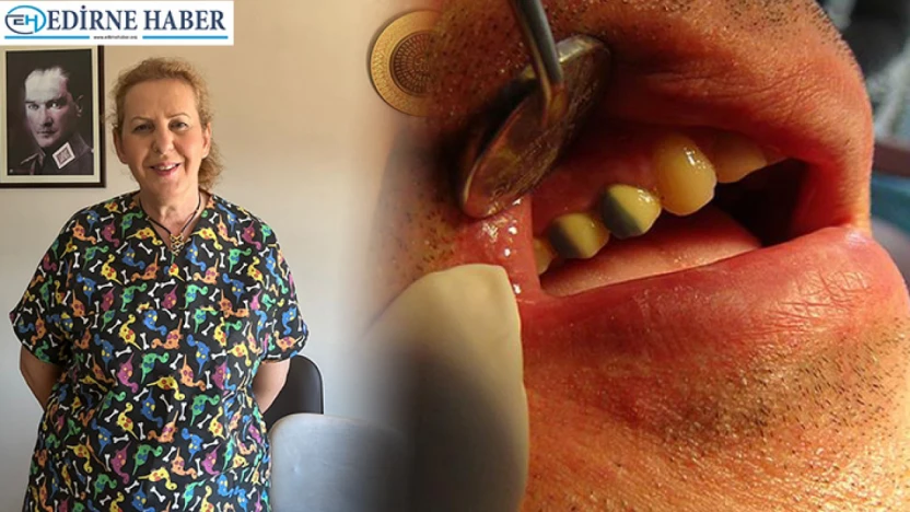 Kaplama diş neden düşer?