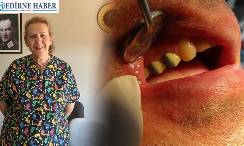 Kaplama diş neden düşer?